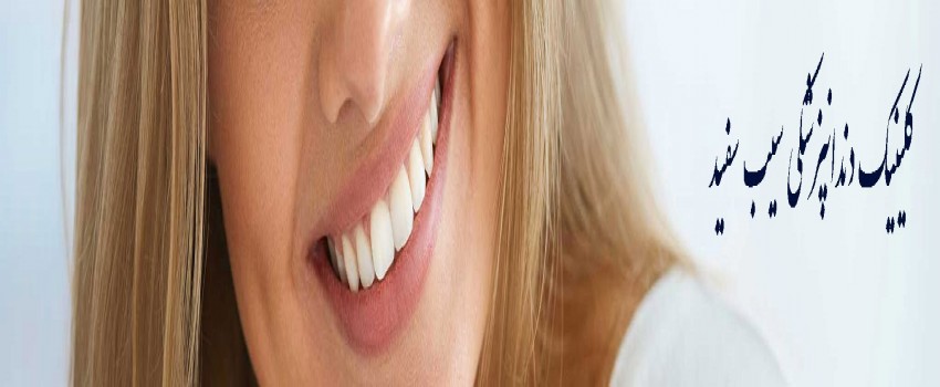 طول عمر ایمپلنت دندان