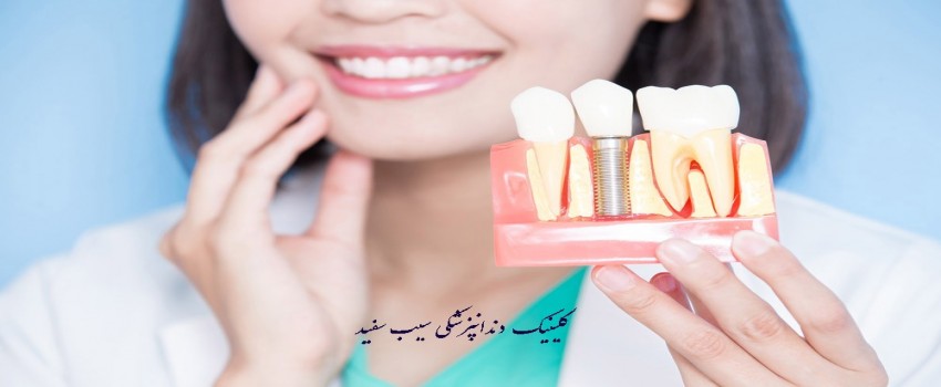 چه کسانی می توانند ایمپلنت دندان انجام دهند؟