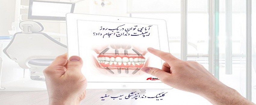 فیلم فناوری جدید ایمپلنت کل دهان در همان روز