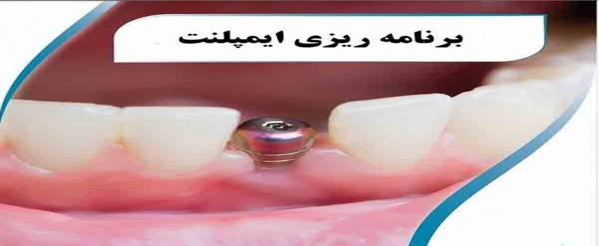 برنامه درمان ایمپلنت دندان