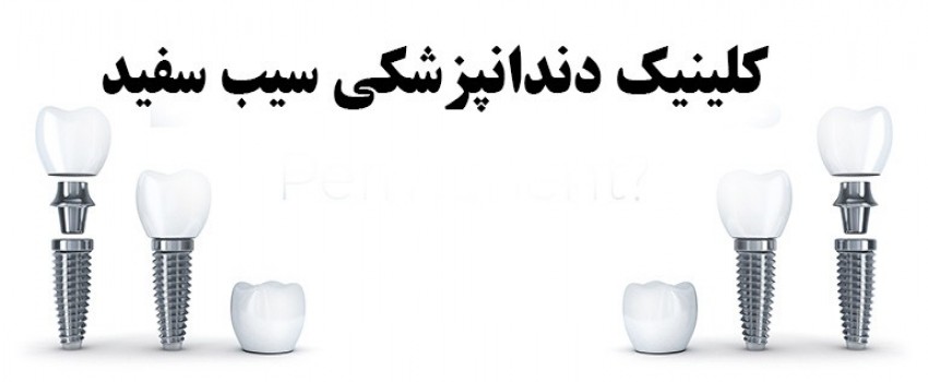 آیا ایمپلنت دندان دائمی است؟