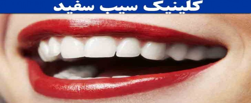 بهترین رنگ کامپوزیت دندان