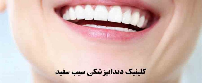 مشکلاتی که کامپوزیت ونیر غیر اصولی ایجاد می کند، چیست؟