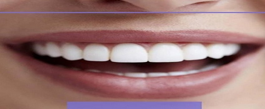 انتخاب رنگ کامپوزیت ونیر بر چه مبنایی است؟