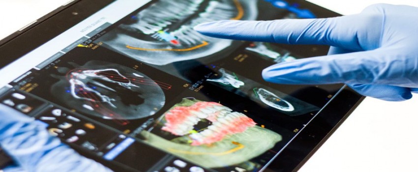 چرا باید از ایمپلنت انجام دهیم؟