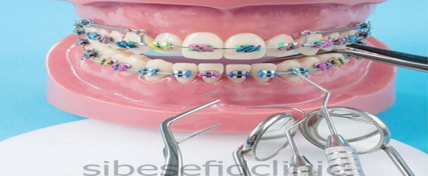 آیا ارتودنسی محدودیت سنی دارد؟