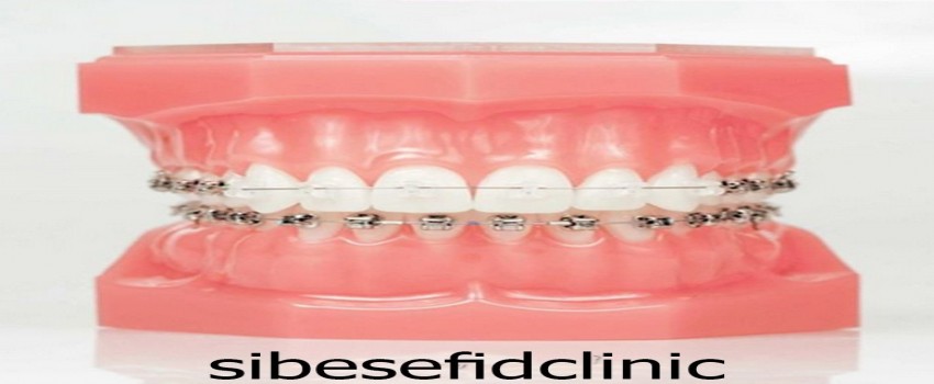 ارتودنسی بزرگسالان