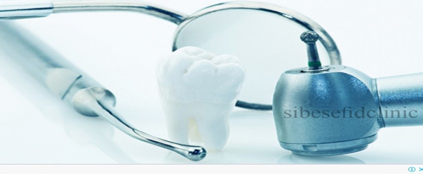 آيا کامپوزيت ونیر می تواند باعث بروز مشکلات دندانی مثل پوسيدگی شود؟