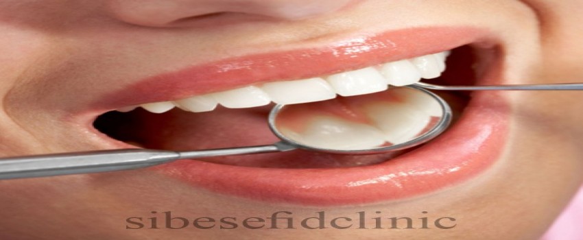 رنگ دندان چقدر سفيد باشد بهتر است؟