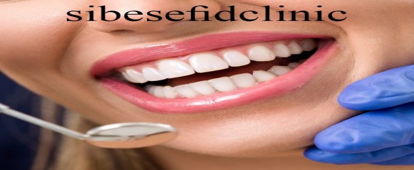 کاندید مناسب برای کامپوزیت ونیر چه کسی است؟