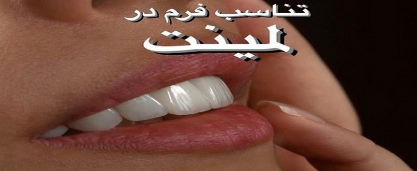 لمینت چطور به دندان می چسبد؟