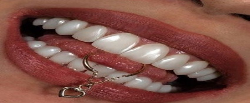 آیا کامپوزیت می تواند باعث بوی دهان بشود؟