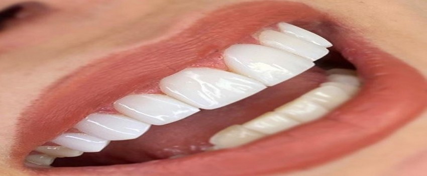 در چه مواردی کامپوزیت به عنوان گزینه‌ درمانی به حساب می‌آیند؟