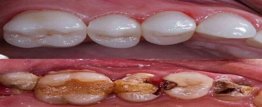 چرا باید به متخصص اندو مراجعه کنیم؟