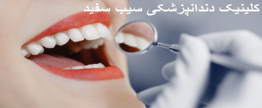 پاسخ متخصصین به سوالات رایج در مورد ایمپلنت دندانی