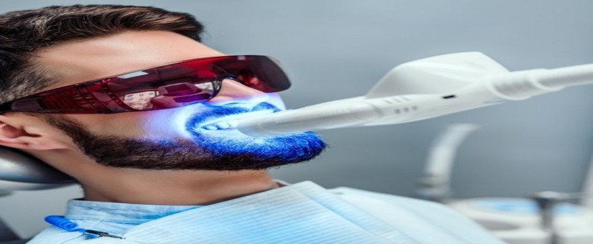 آخرین هزینه بلیچینگ دندان در سال 1402