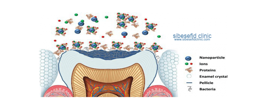 کامپوزیت نانوفیل (نانوکامپوزیت) دندان چیست؟